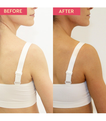 Self Tan Dark Foaming Mousse - Dark Tan - Quick Dry - Easy to Apply - 150ml