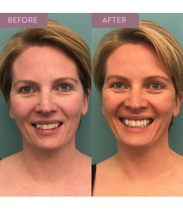 Self tan Light Tan 50 ml Hyaluronic Self Tan Balm 50ml - Facial Night Tan