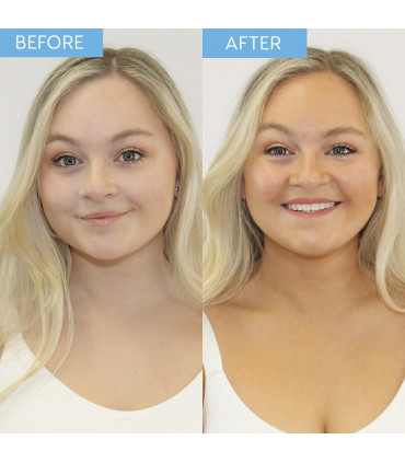 Facial Water Mist Hydrate Glow Self-Tan Hyaluronic Acid Natural DHA 100% Vegan