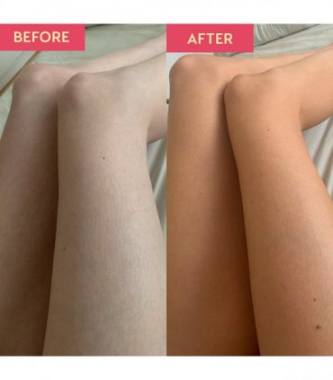 Self Tan Dark Foaming Mousse - Dark Tan - Quick Dry - Easy to Apply - 150ml