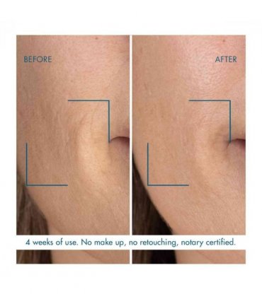 Biotherm Blue Thera Retinol Night Concentrate MV 30ml